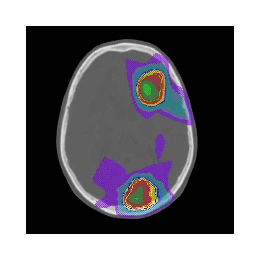Onesite web image MRCAT Brain