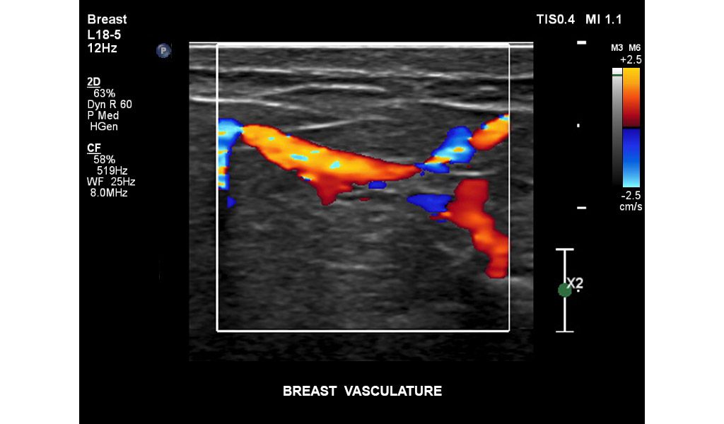 Breast vasculature