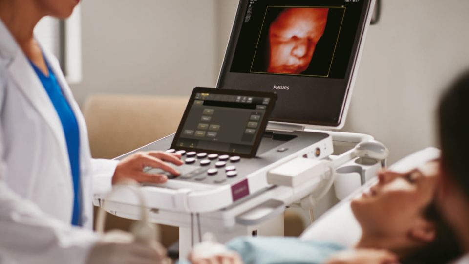 Clinician performing exam with Philips Compact 5000 series ultrasound