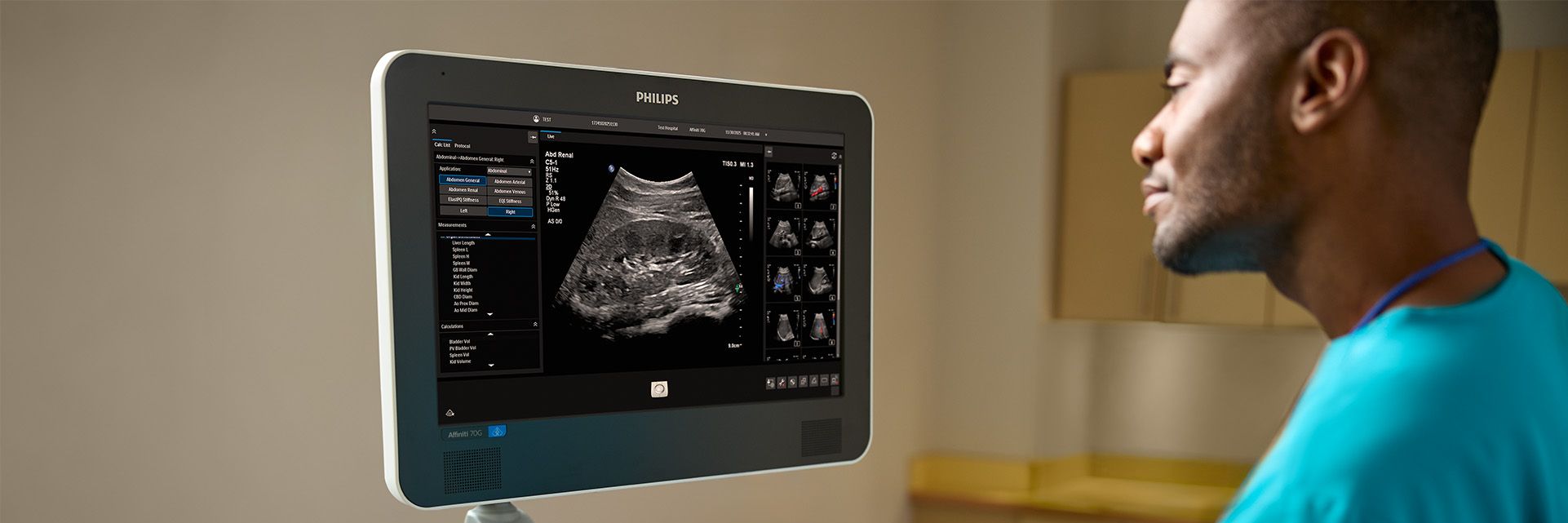  Sonographer looking at an abdominal ultrasound image 