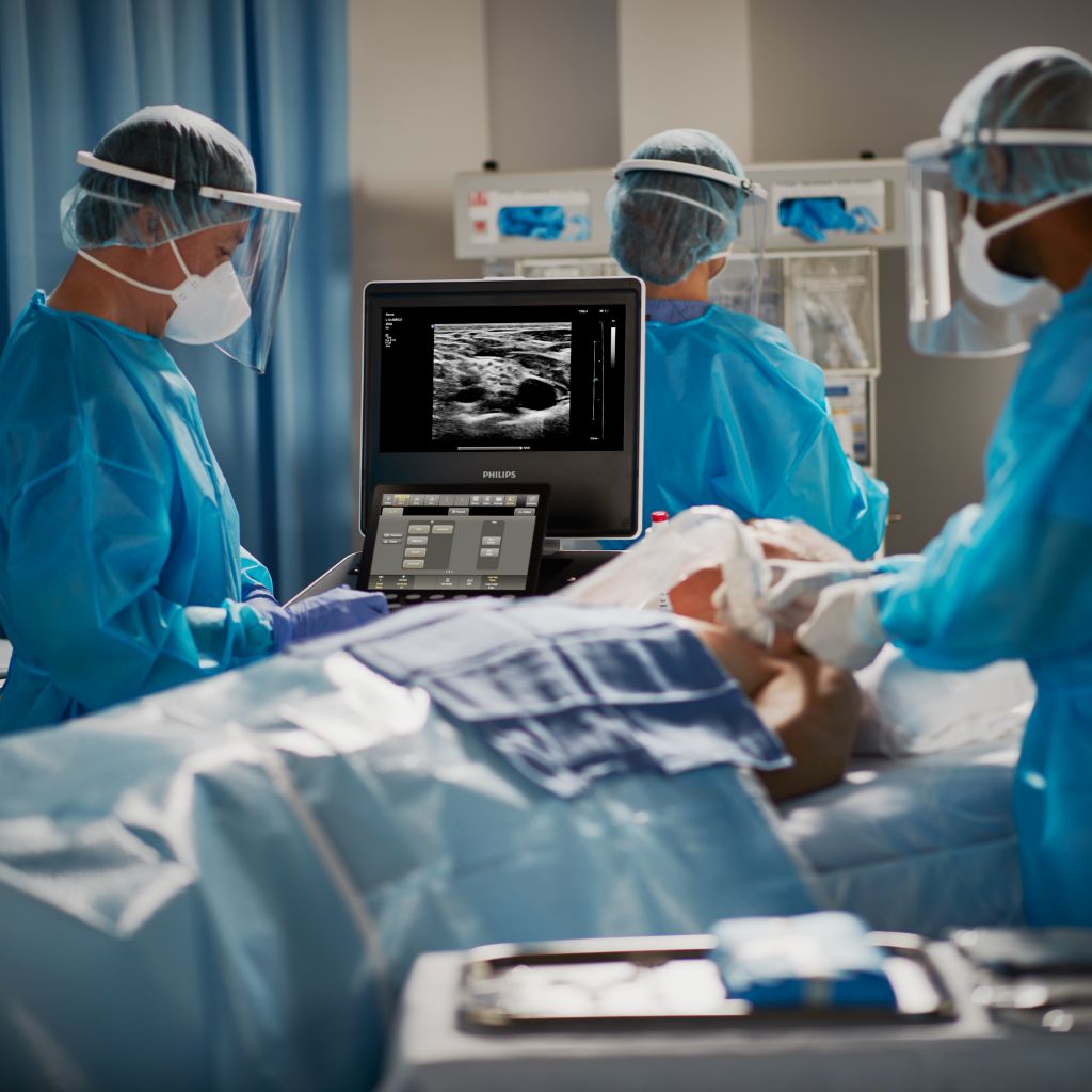 Compact Ultrasound System 5000 series