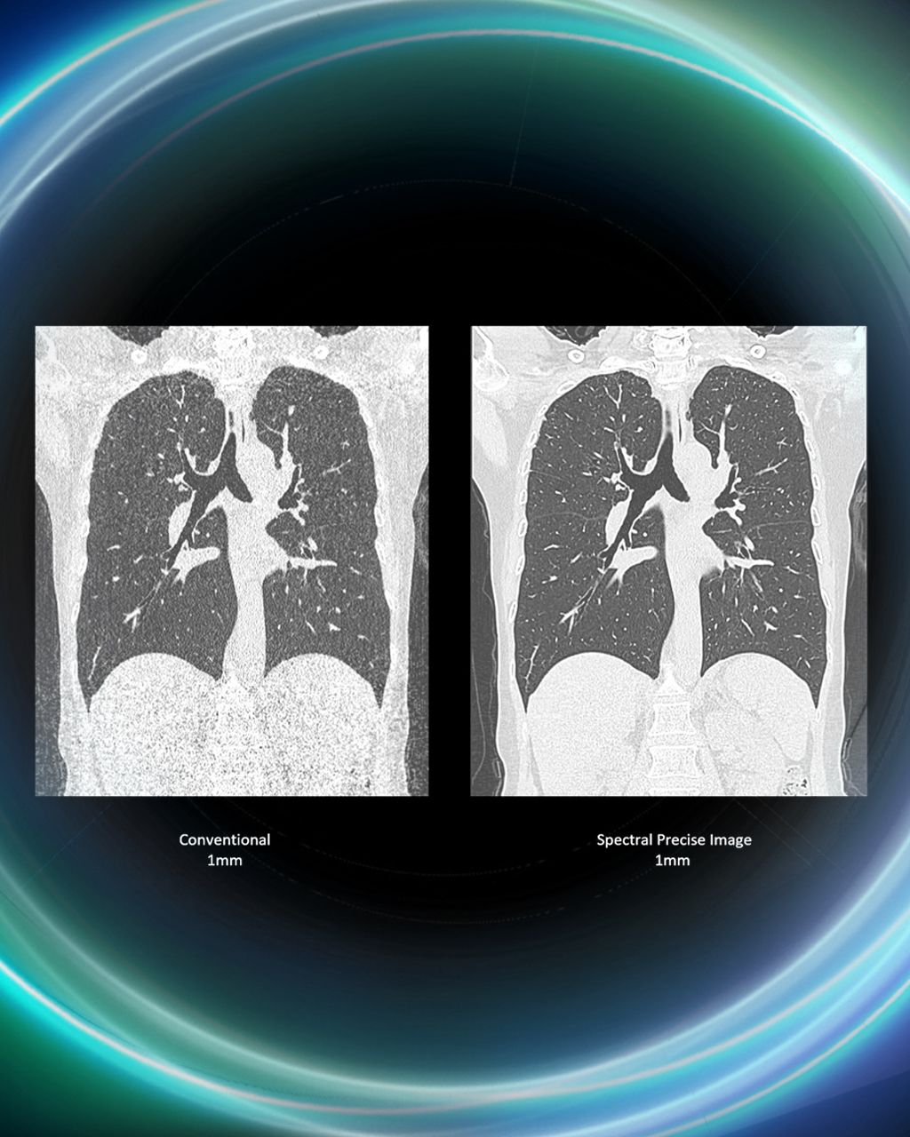Spectral Precise Image