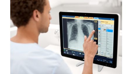 UNIQUE 2¹ — przetwarzanie obrazów radiograficznych nowej generacji