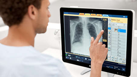UNIQUE 2¹ — новое поколение технологии постобработки рентгеновских изображений 