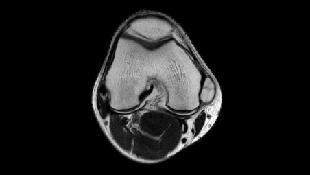 Tecniche per l'imaging di routine di alta qualità