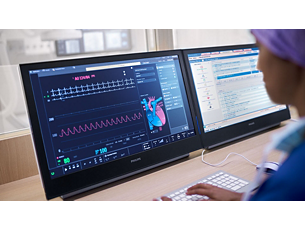 Xper IM with Philips Hemo Cardiovascular workflow solution