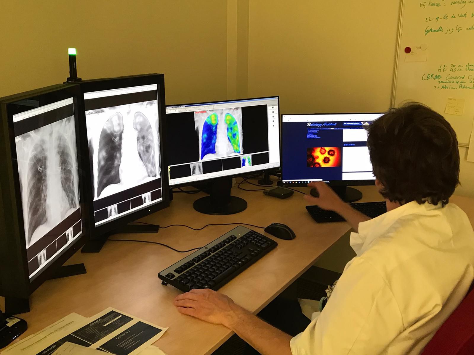 Clinician analyzing chest X ray images with AI software to detect COVID 19