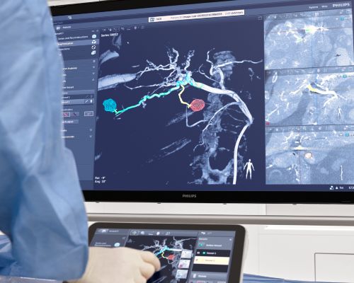 SmartCT 3D imaging