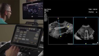Philips Ultrasound FlexVue and Orthogonal View Demonstration by Dr. Michael Ruma 