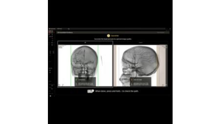 Isocentering tool to aid with accurate positioning of the patient’s head​​