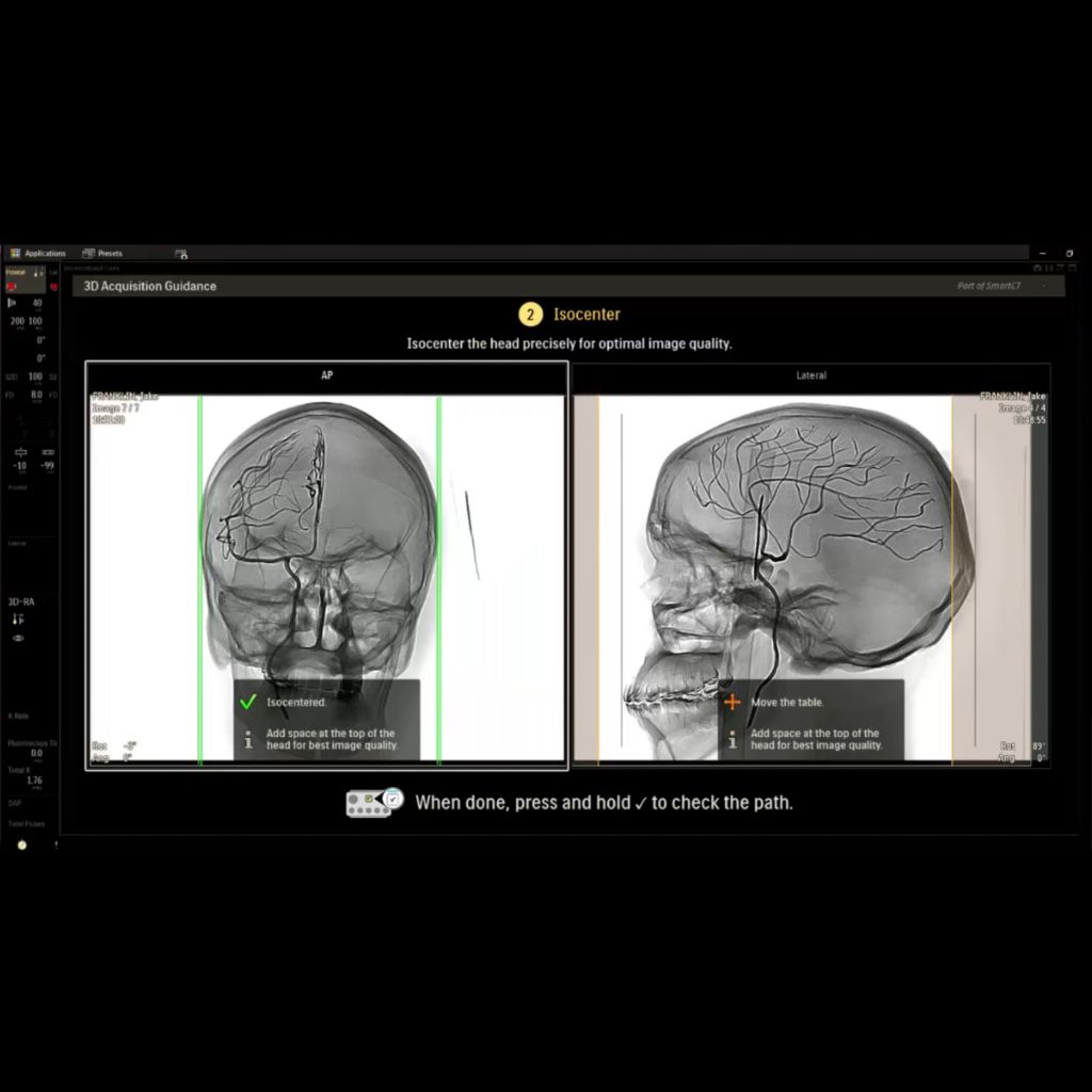 Isocentering tool to aid with accurate positioning of the patient’s head​​