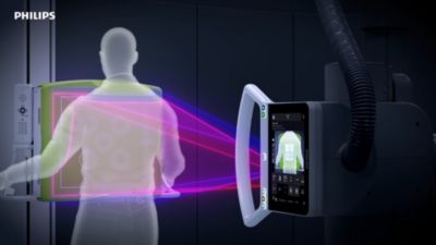 Smart Collimation Thorax activated