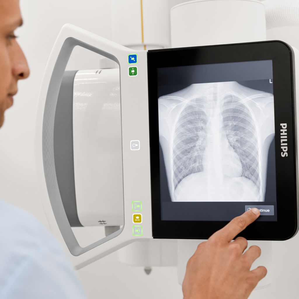 Improved Pediatric diagnostic image quality