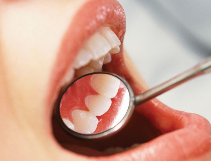 Sonicare HealthyWhite