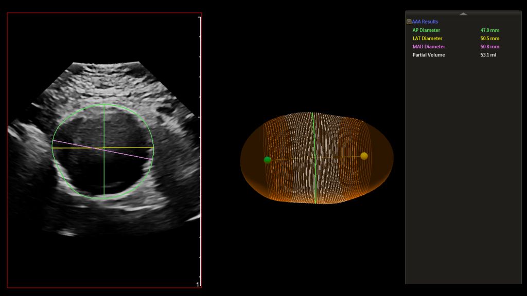 EPIQ X6-1_AAA Measurements