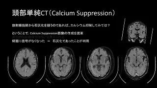 case 66
救急現場での頭部CT ～出血？石灰化？梗塞？～