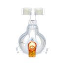 Respironics AF531 Oro-Nasal Mask, Small, 10-Pack