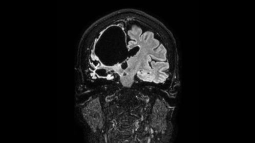 3D BrainVIEW FLAIR