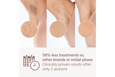 IPL hair removal device: go 12 months hair-free