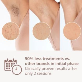 Philips Lumea IPL 7000 Series IPL hair removal device: go 12 months hair-free