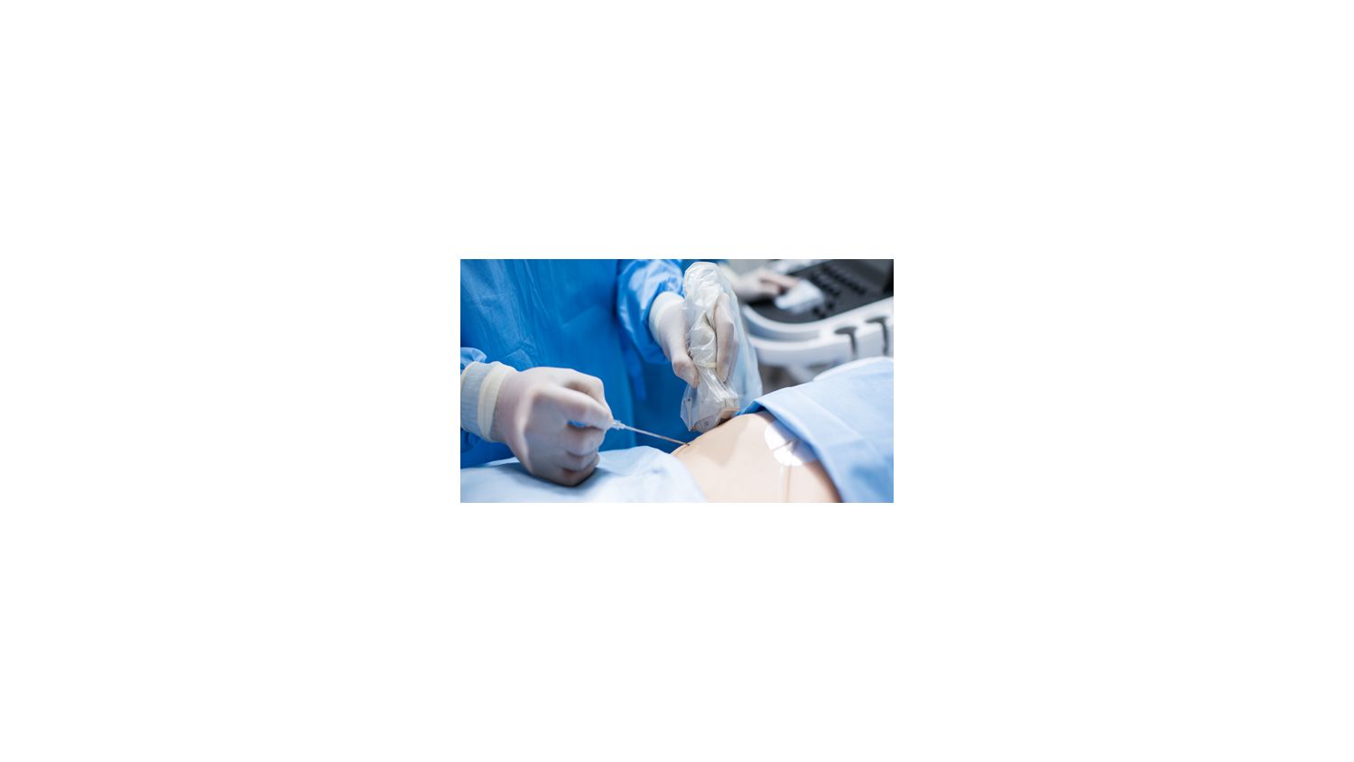 Biopsy Guide