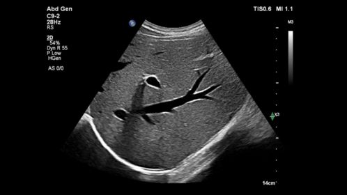 C9-2 Abdomen Liver