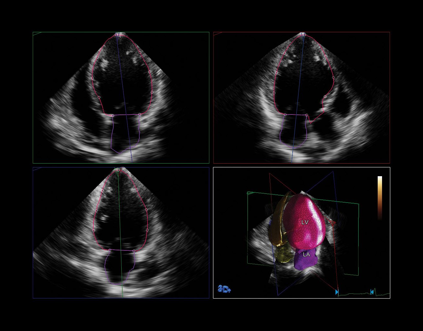 HeartModel clinical image