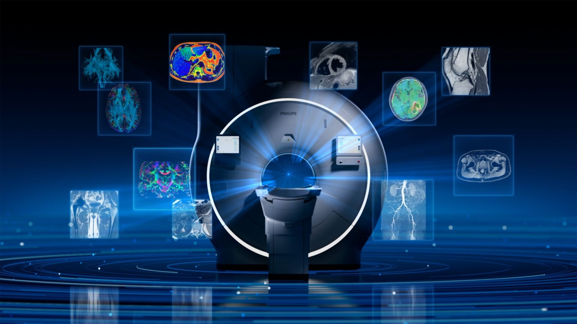 Phllipst Titanion 3.0T MRI