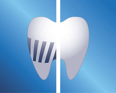 A bifurcated tooth graphic signifying enamel protection