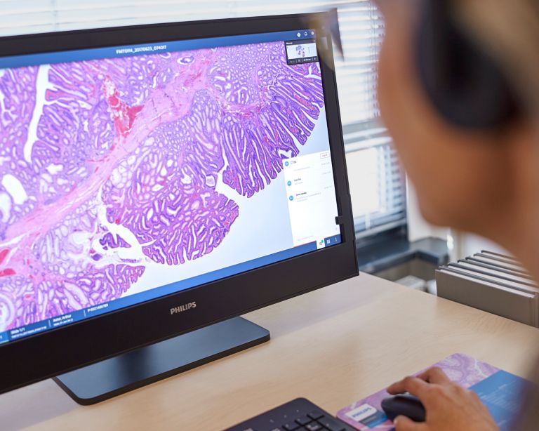 Philips - Pathology Scanner Second Generation SG300 - Philips