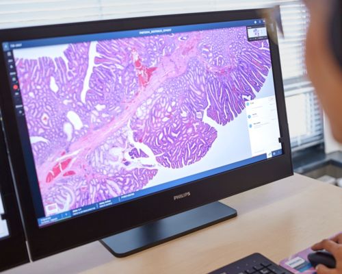 image of Philips IntelliSite Pathology Solutions