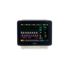 IntelliVue MX450 thumbnail
