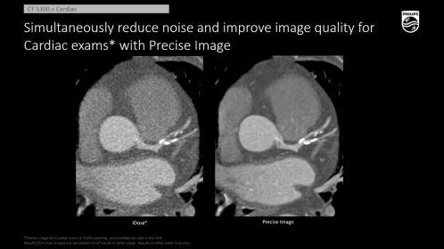 CT 5300 Precise Cardiac