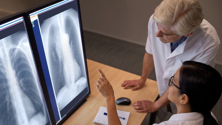 Miglioramento dell'immagine mediante Bone Suppression