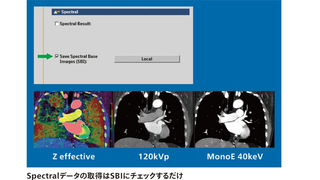 Spectralデータの取得はSBIにチェックするだけ