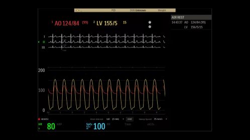 Hemo user interface Tavi exam room