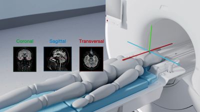 Introduction to MRI gradient safety
