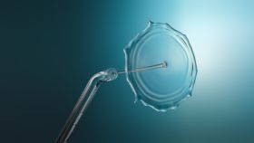 Compact Flosser 1000