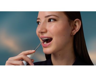 矯正装置やブラケットをケア