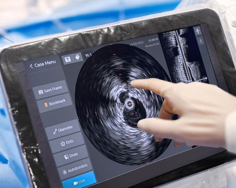  ivus catheters