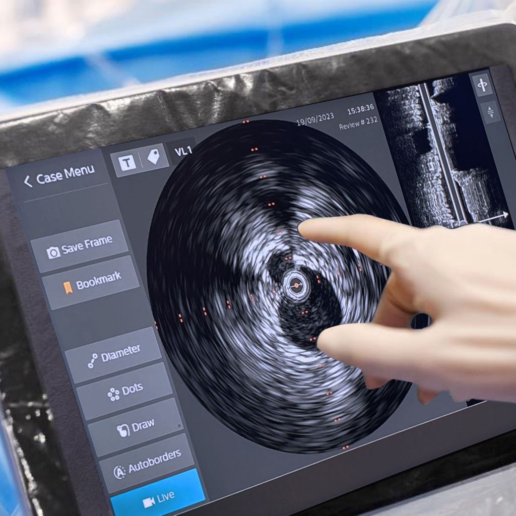 Advanced visualization with IVUS catheters