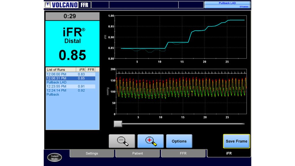 iFR Scout pullback