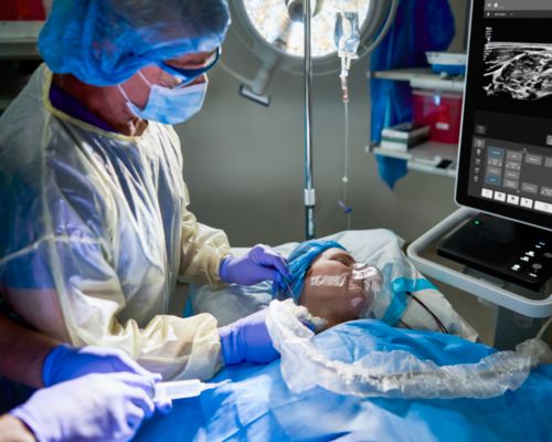 Anesthesia clinical setting showing interscalene block using eL18-4 transducer.