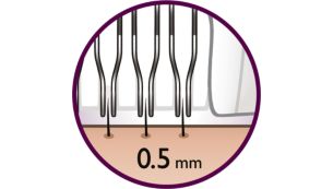 Tämä epilointijärjestelmä poistaa jopa vain 0,5 mm pituiset ihokarvat