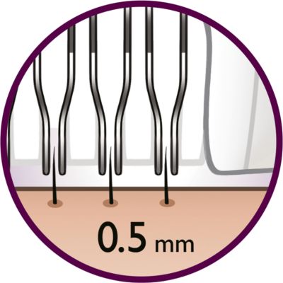This epilation system removes hair as short as 0.5 mm