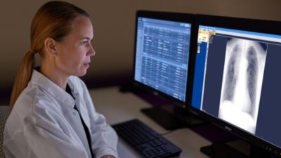 Radiologist reviewing chest x ray image on diagnostic workstation