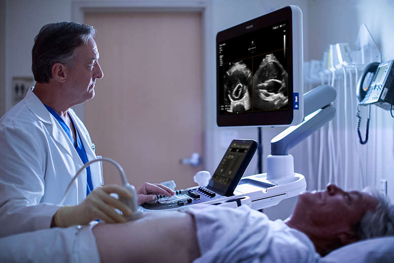 Clinician uses Philips EPIQ Elite AAA to perform an ultrasound on an abdominal aortic aneurysm patient