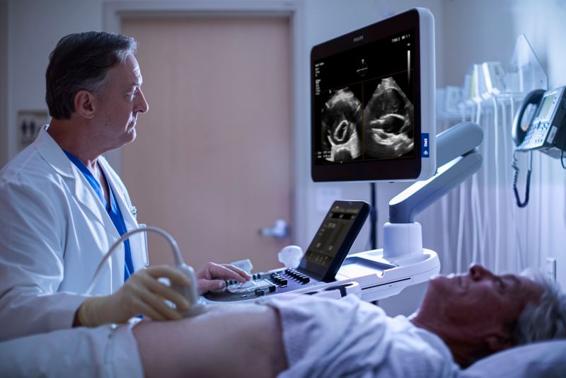 Clinician uses Philips EPIQ Elite AAA to perform an ultrasound on an abdominal aortic aneurysm patient