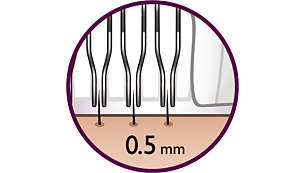 Questo sistema di epilazione consente di eliminare i peli di minimo 0,5 mm