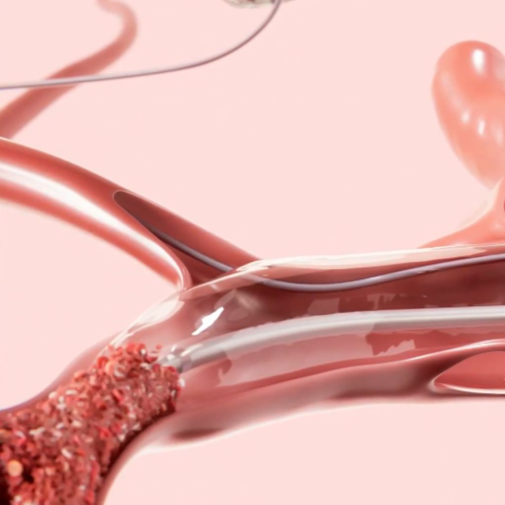 Reduce blood loss and save lives